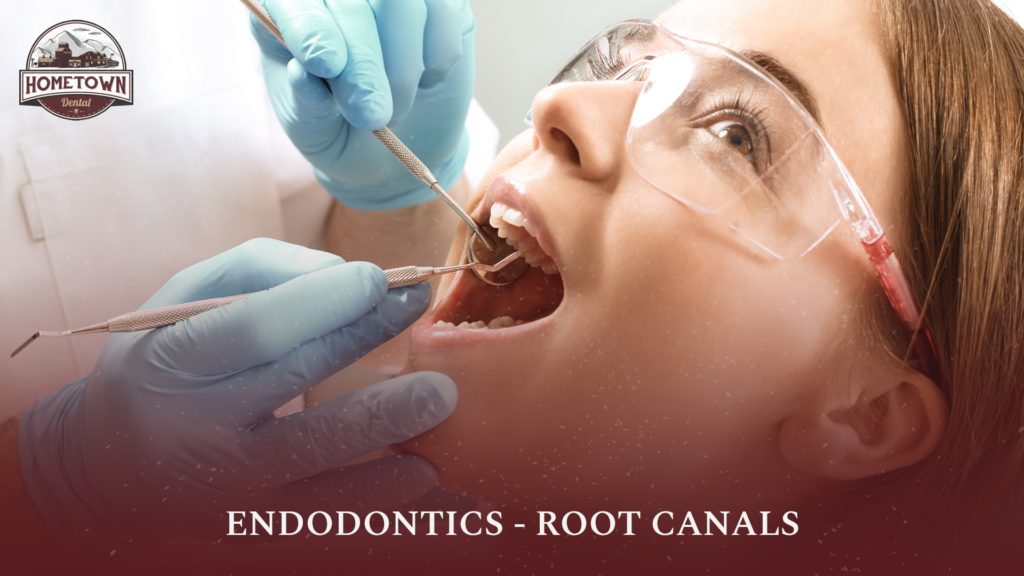 hometown-dental-blog-fullsize-endodontics