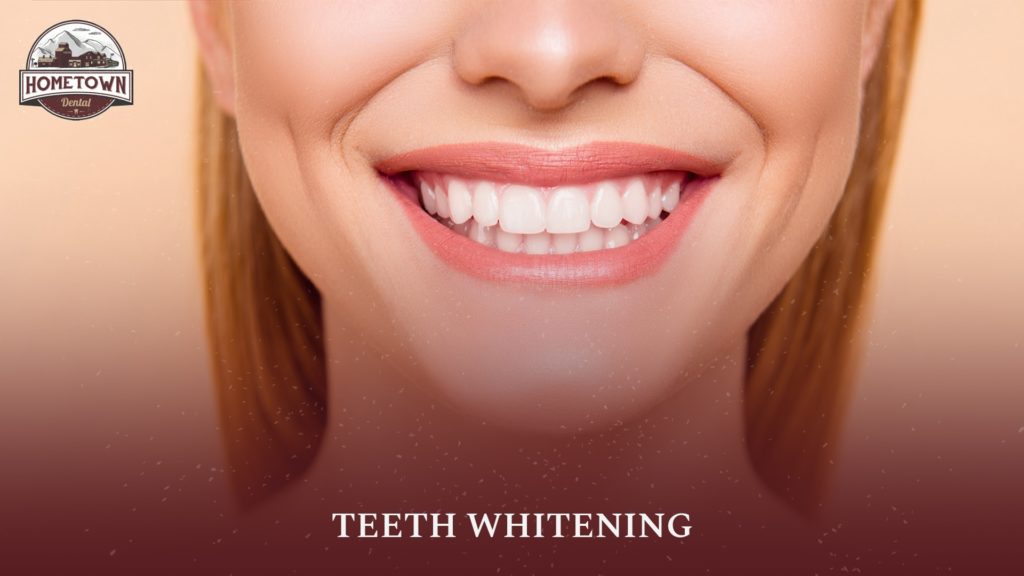hometown-dental-blog-fullsize-teethwhitening