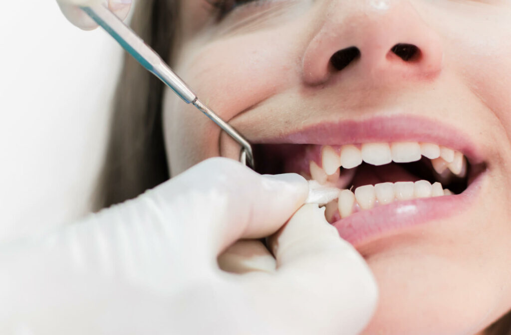 A dentist's hand  placing gauze in the mouth of a woman after a tooth is extracted